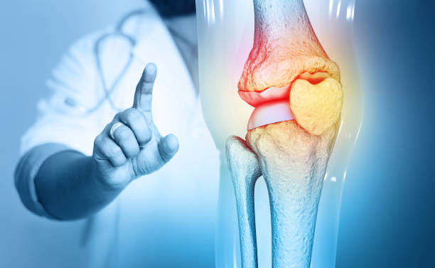 Best Treatment Options for Joint Pain in Knees