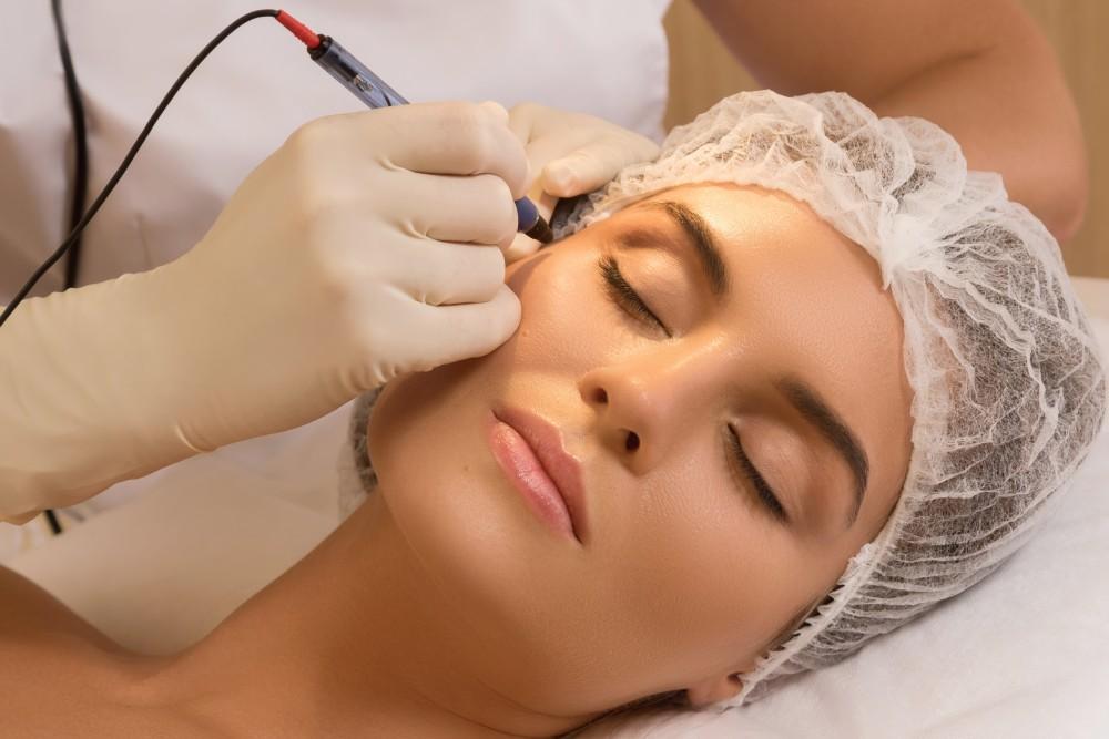 Microneedling for Collagen Production: What You Need to Know