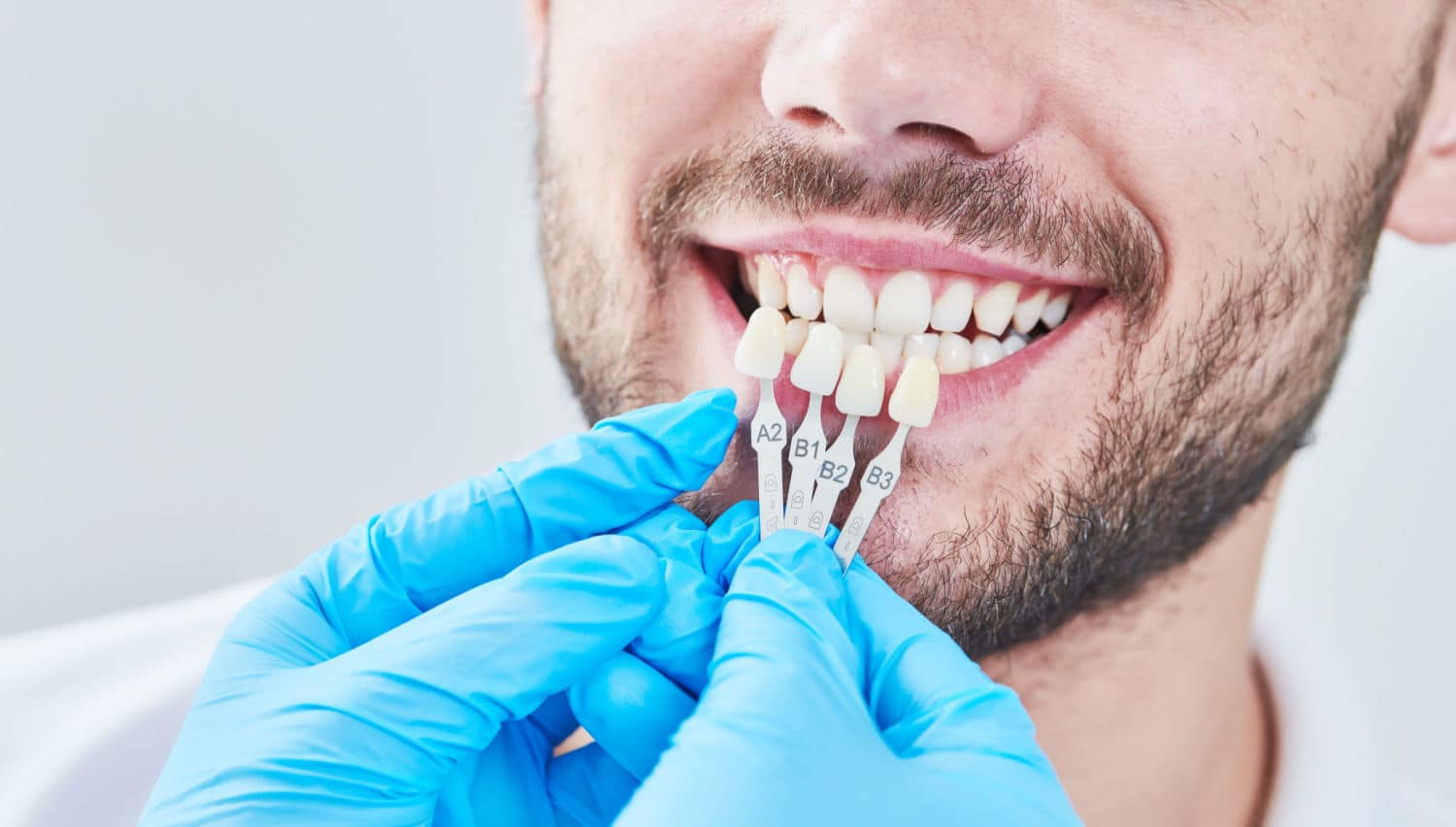 Choosing the Right Teeth Whitening Treatment for Your Needs
