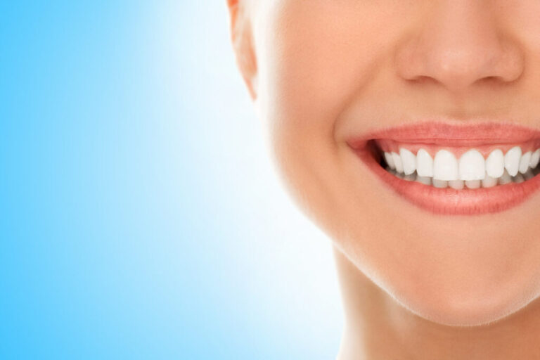 Exploring The Best Home Remedies For Teeth Whitening