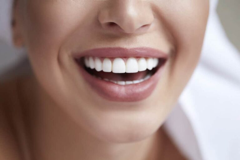 How Veneers Transform Your Smile Naturally