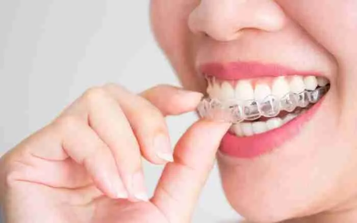 The Role of Technology in Modern Teeth Straightening