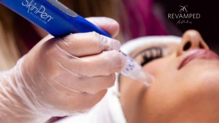 Comparing Different Laser Treatments for Skin Concerns