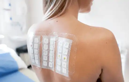 Is Allergy Testing Necessary for Kids?