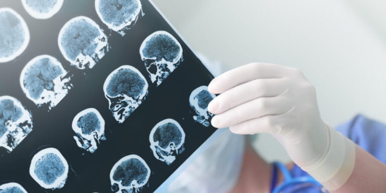 Exploring the Neuroscience Behind Brain Surgery