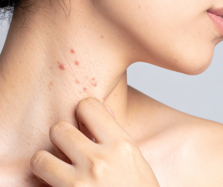 Finding the Right Dermatologist for Acne and Other Conditions