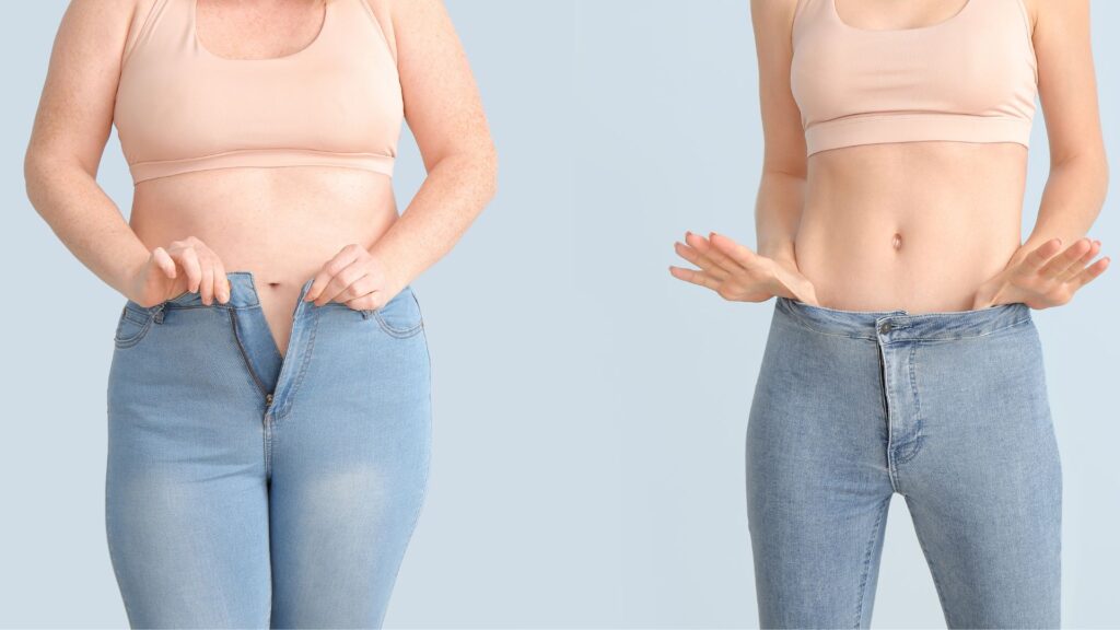 How Gastric Sleeve Surgery Can Change Your Life
