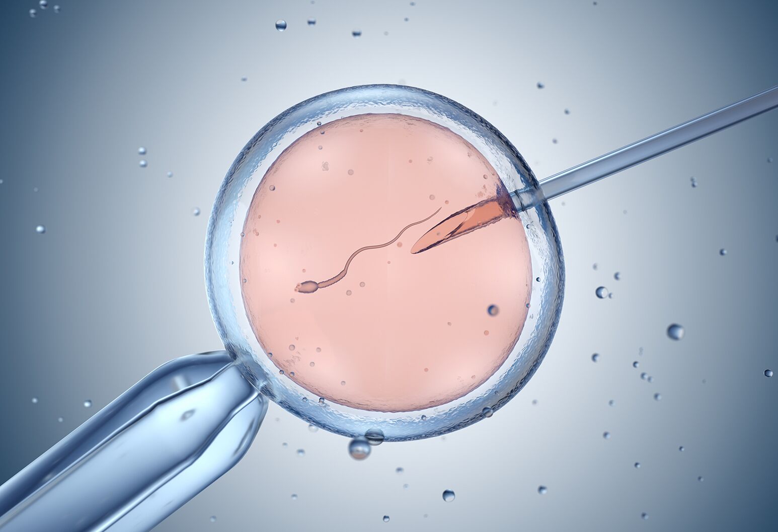 How to Prepare for Your First In Vitro Fertilization Cycle