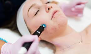 Hydrafacial Aftercare Tips for Long-lasting Results