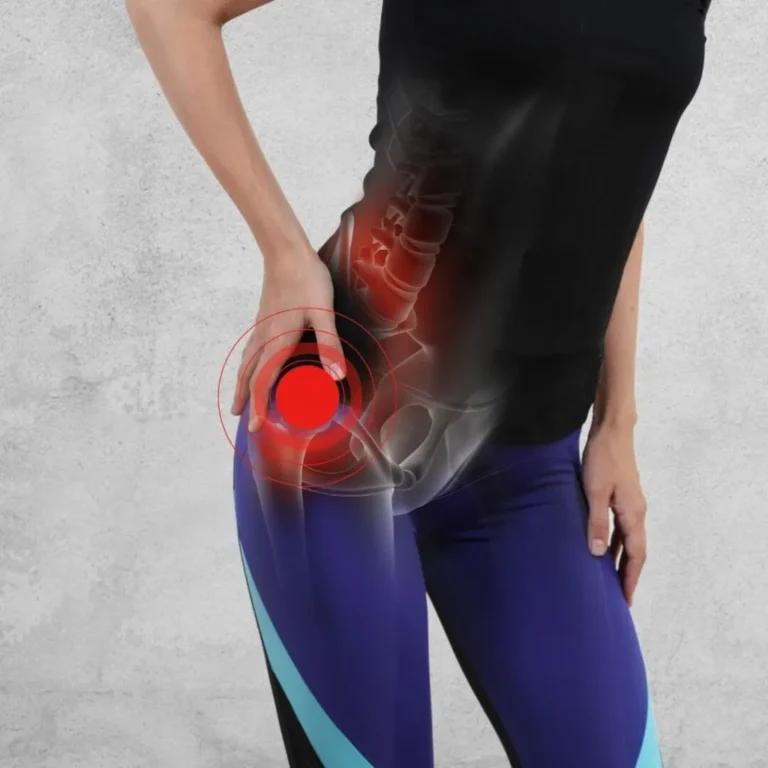 Identifying Common Sciatica Symptoms and When to Seek Help