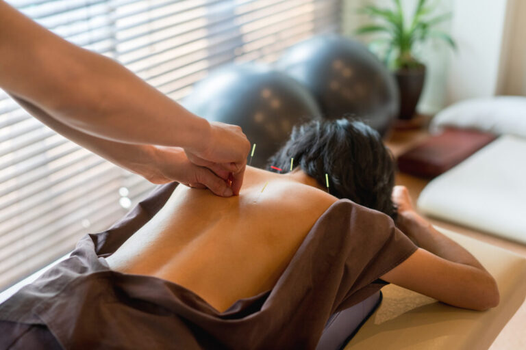 Questions To Ask During Your Consultation With an Acupuncturist