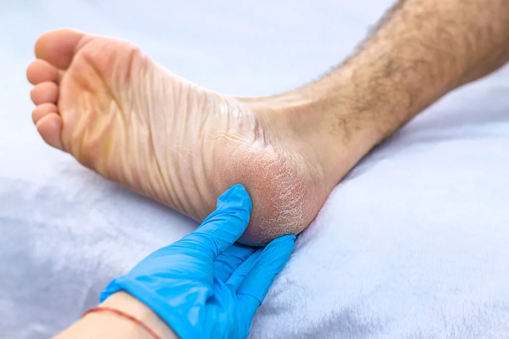 Reasons to Visit a Foot Doctor