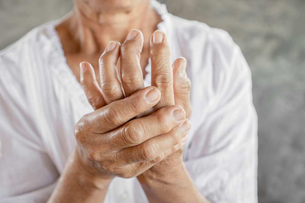 The Connection Between Arthritis and Overall Health