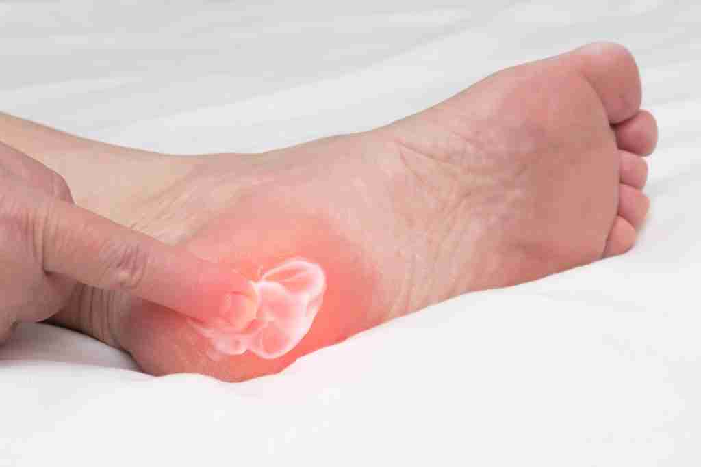 The Role of Foot Care for Individuals With Plantar Fasciitis