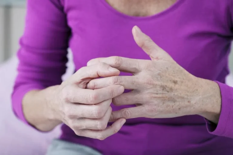 Tips for Living With Arthritis