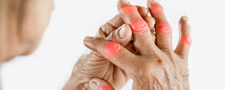 Types of Arthritis and Available Treatments