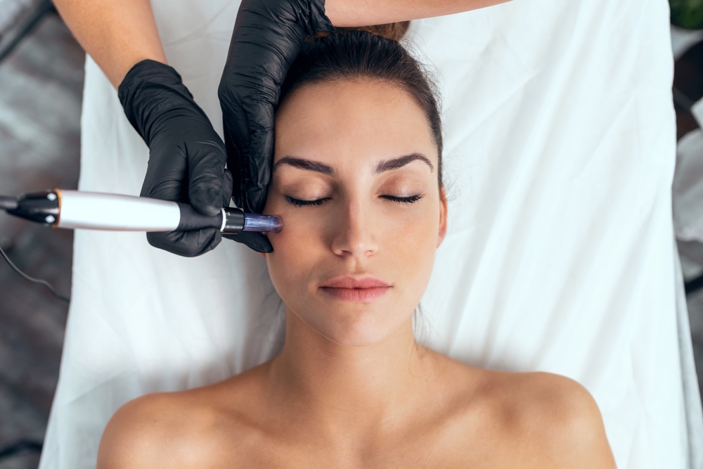 Understanding How Microneedling Enhances Your Skin