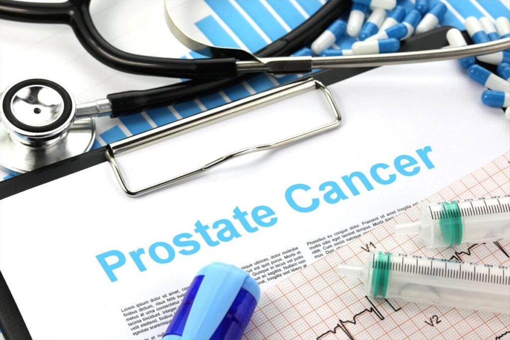 Understanding the Benefits of a Second Opinion from a Prostate Cancer Doctor