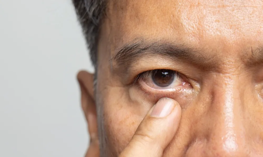 Understanding the Role of a Cataract Surgeon in Restoring Vision