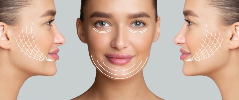 What You Need To Know About Face Lift Surgery Techniques