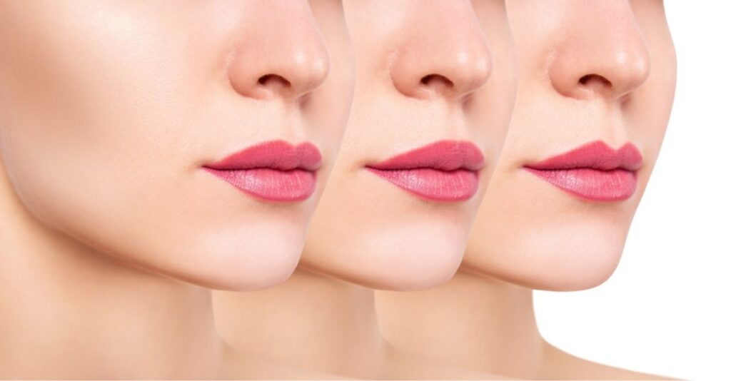 A Guide to Lip Fillers and When You Might Need Them