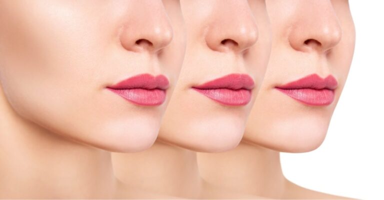 A Guide to Lip Fillers and When You Might Need Them